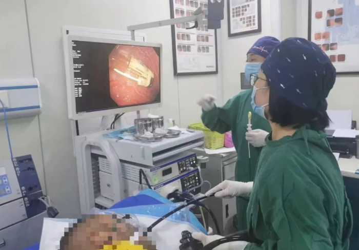 阜康医院配合公安民警为嫌疑人胃镜下取出吞入物